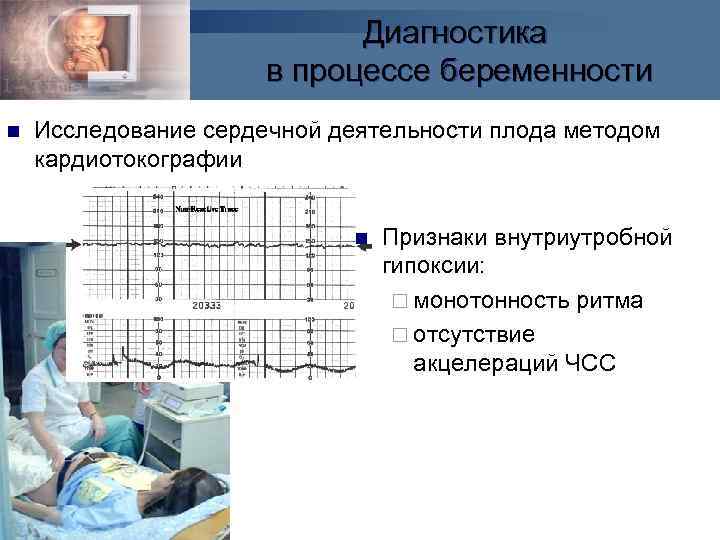 Тесты с ответами гипоксия плода. Методы диагностики гипоксии плода. Кардиотокография плода гипоксия. Степени гипоксии плода по КТГ. Внутриутробная асфиксия плода.