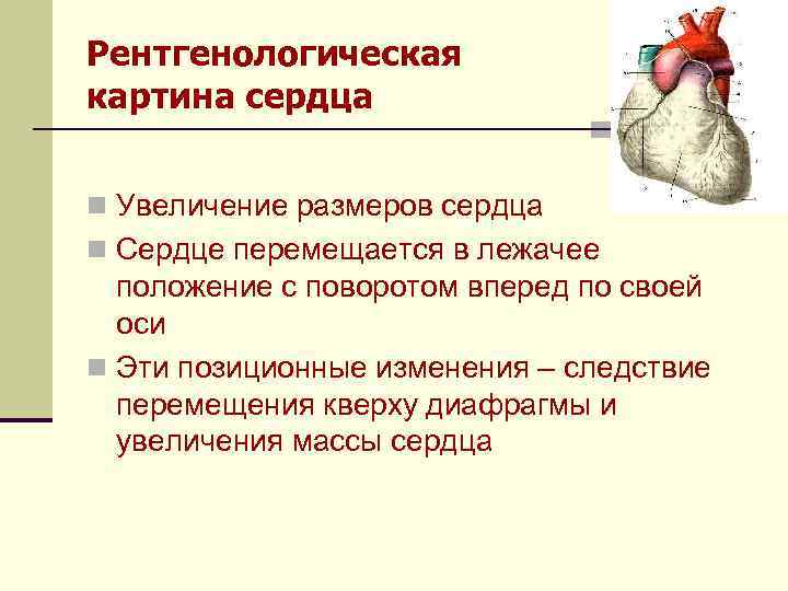 Рентгенологическая картина сердца n Увеличение размеров сердца n Сердце перемещается в лежачее положение с