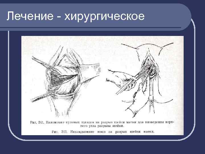 Лечение - хирургическое 