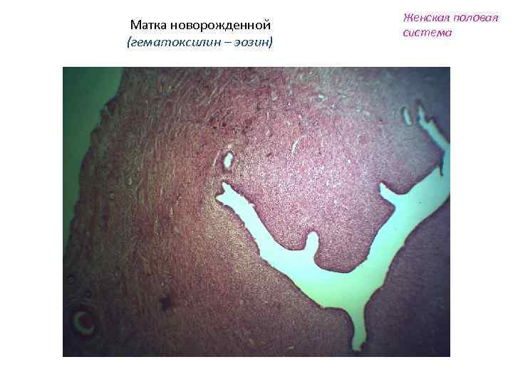 Матка новорожденной (гематоксилин – эозин) Женская половая система 