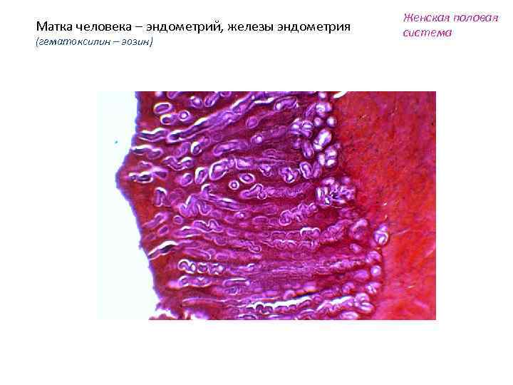 Матка человека – эндометрий, железы эндометрия (гематоксилин – эозин) Женская половая система 