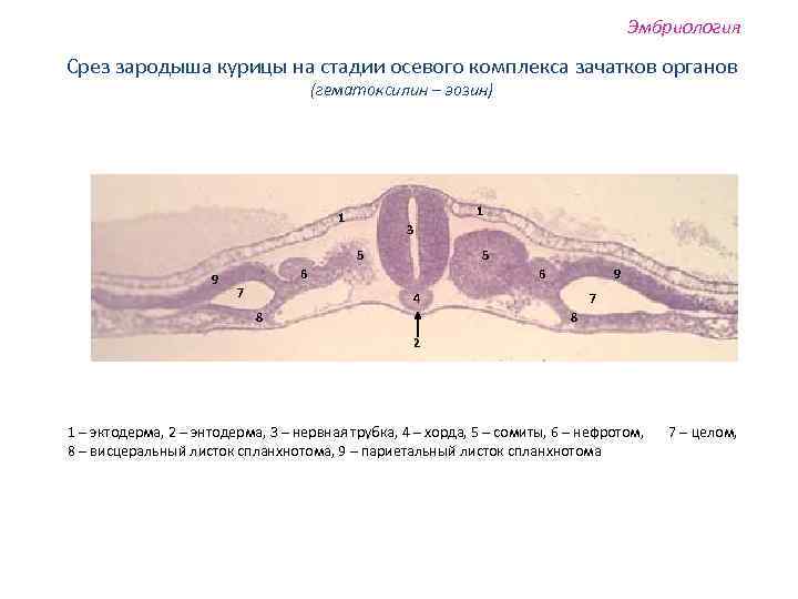 Эмбриология Срез зародыша курицы на стадии осевого комплекса зачатков органов (гематоксилин – эозин) 1