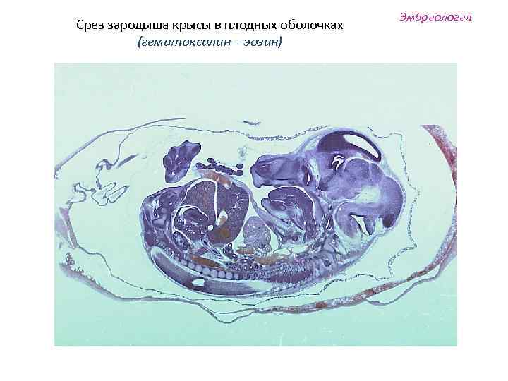 Срез зародыша крысы в плодных оболочках (гематоксилин – эозин) Эмбриология 