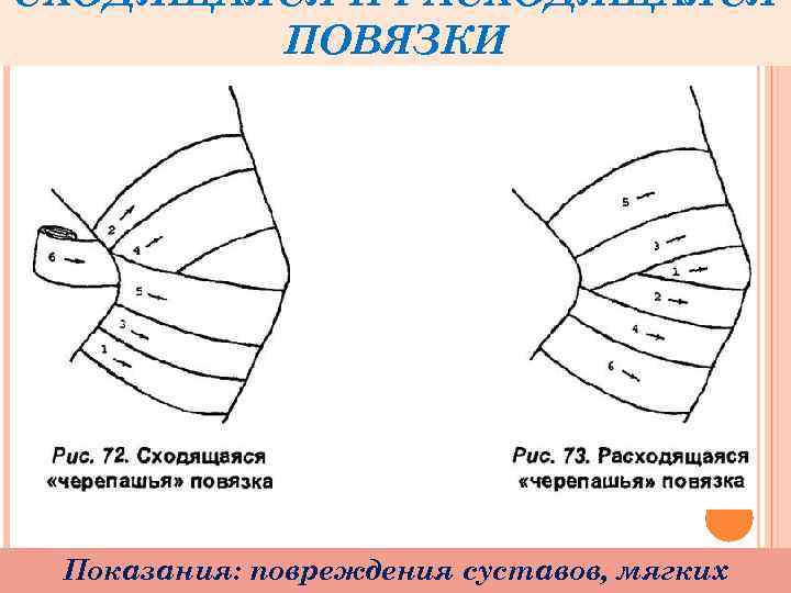 СХОДЯЩАЯСЯ И РАСХОДЯЩАЯСЯ ПОВЯЗКИ Показания: повреждения суставов, мягких 