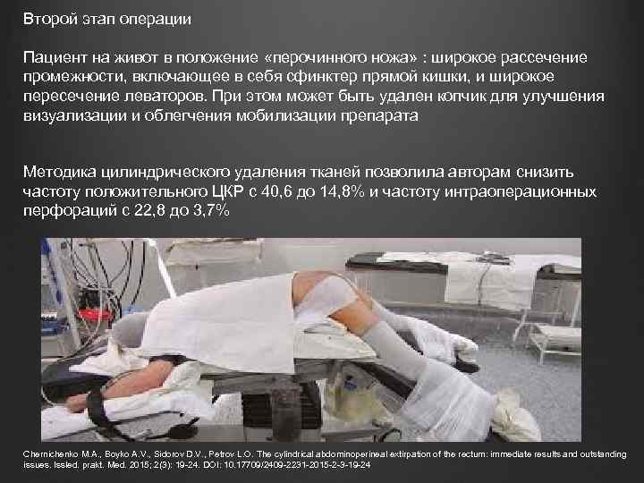 Второй этап операции Пациент на живот в положение «перочинного ножа» : широкое рассечение промежности,