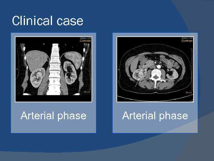 Clinical case Arterial phase 