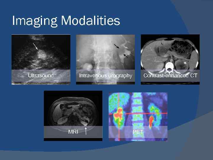 Imaging Modalities Ultrasound Intravenous urography MRI Contrast-enhanced CT PET 