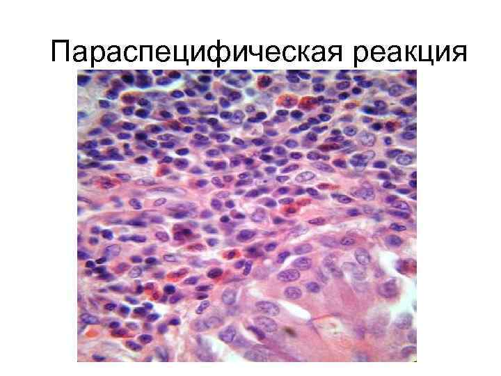 Параспецифическая реакция 