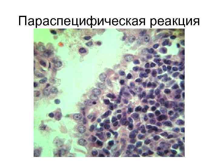 Параспецифическая реакция 
