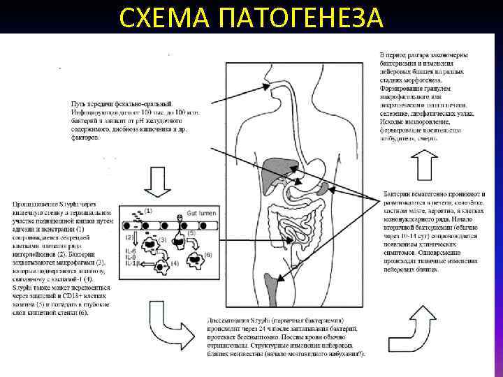 СХЕМА ПАТОГЕНЕЗА 