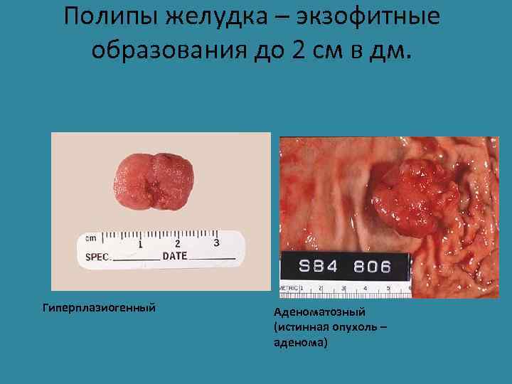 Заболевания желудочно кишечного тракта картинки