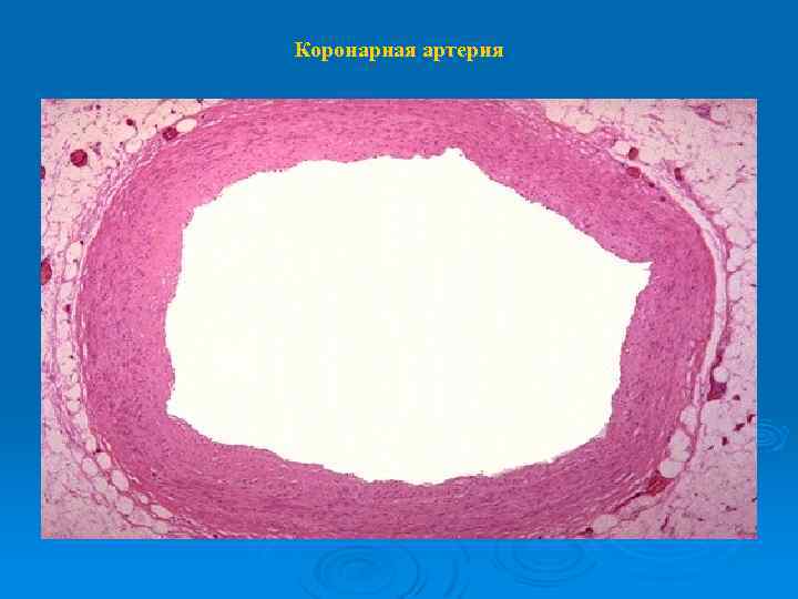 Коронарная артерия 