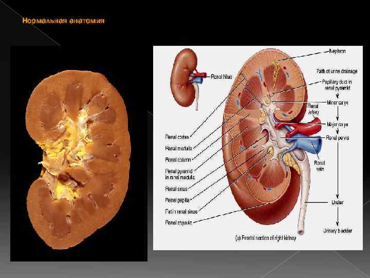 Нормальная анатомия 