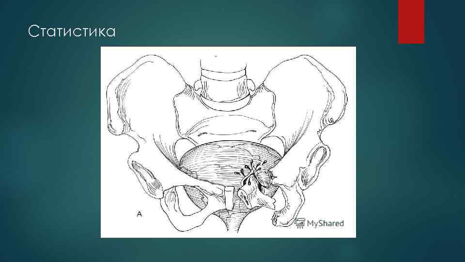 Статистика 