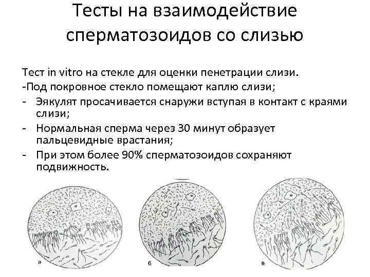 Тесты слизистая. Проба Шуварского. Посткоитальный тест Шуварского-Гуннера. Тест Шуварского что это. Шуварского тест на совместимость.