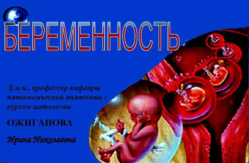Д. м. н. , профессор кафедры патологической анатомии с курсом цитологии ОЖИГАНОВА Ирина Николаевна