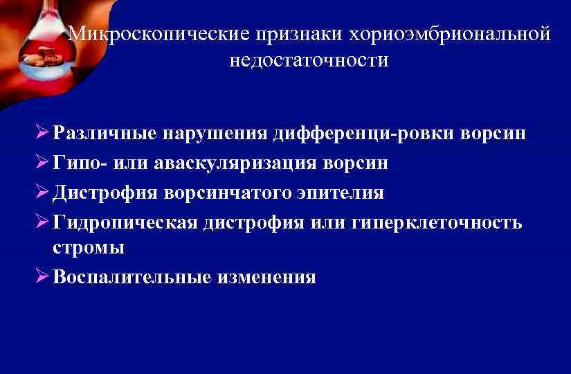 Микроскопические признаки хориоэмбриональной недостаточности Ø Различные нарушения дифференци-ровки ворсин Ø Гипо- или аваскуляризация ворсин