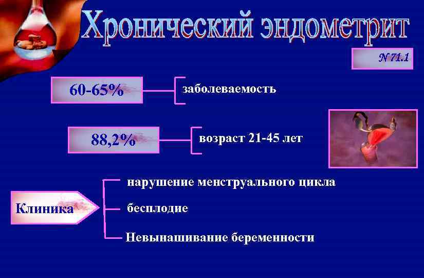 N 71. 1 заболеваемость 60 -65% 88, 2% возраст 21 -45 лет нарушение менструального