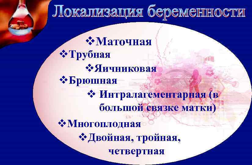 v. Маточная v. Трубная v. Яичниковая v. Брюшная v Интралагементарная (в большой связке матки)
