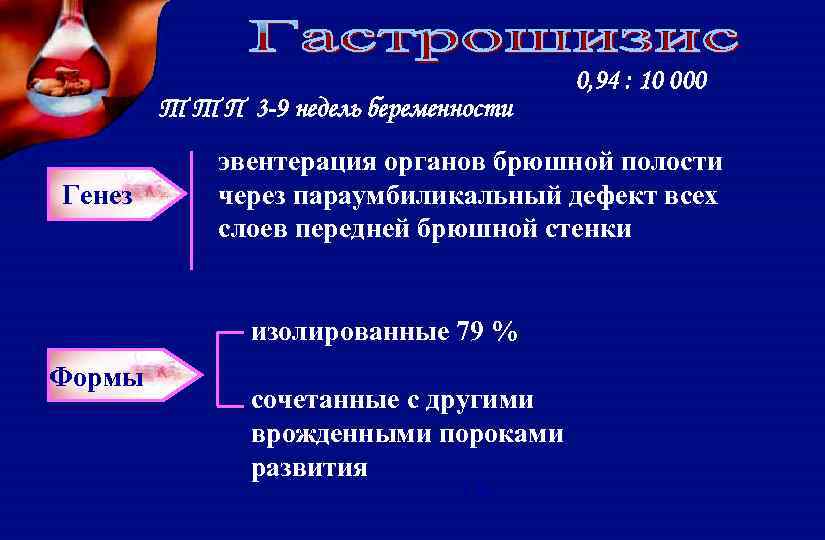 Т Т П 3 -9 недель беременности Генез эвентерация органов брюшной полости через параумбиликальный
