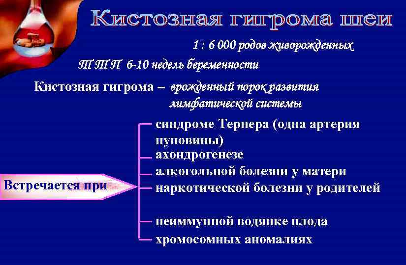 1 : 6 000 родов живорожденных Т Т П 6 -10 недель беременности Кистозная