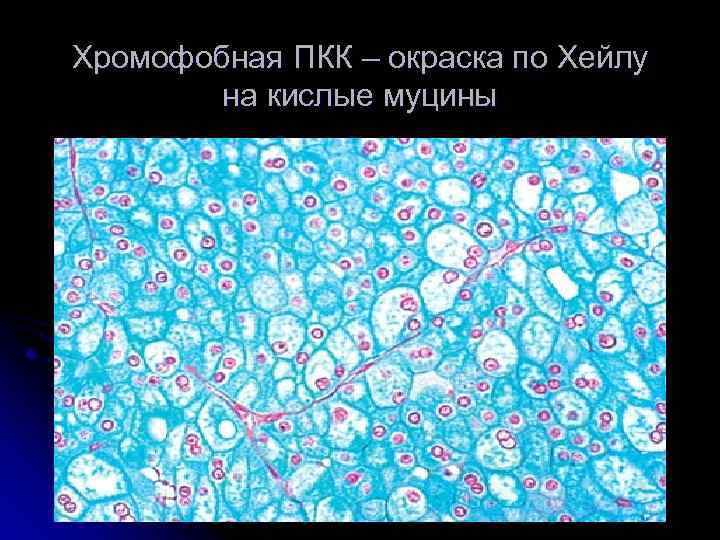 Хромофобная ПКК – окраска по Хейлу на кислые муцины 