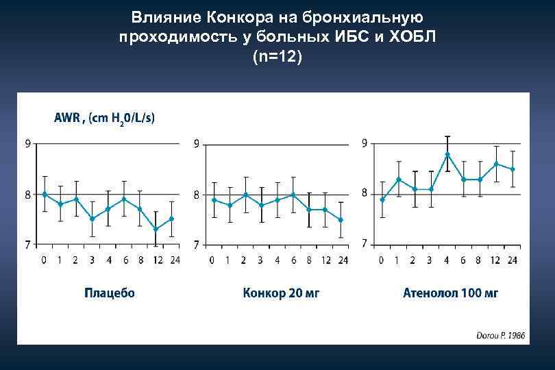 Влияние Конкора на бронхиальную проходимость у больных ИБС и ХОБЛ (n=12) 