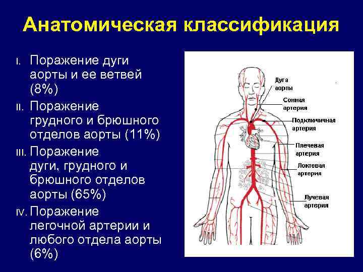 Анатомическая классификация Поражение дуги аорты и ее ветвей (8%) II. Поражение грудного и брюшного