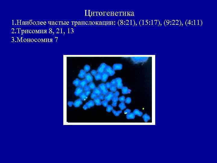 Цитогенетика 1. Наиболее частые транслокации: (8: 21), (15: 17), (9: 22), (4: 11) 2.