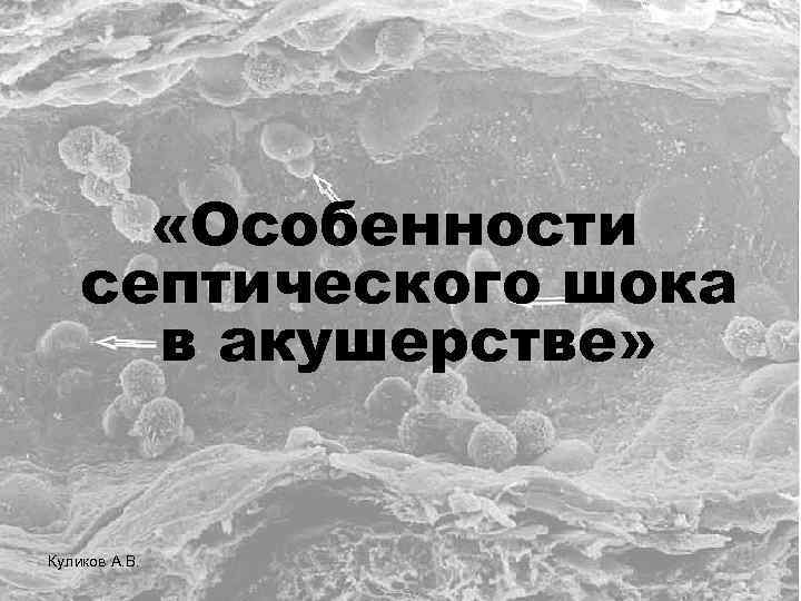  «Особенности септического шока в акушерстве» Куликов А. В. 