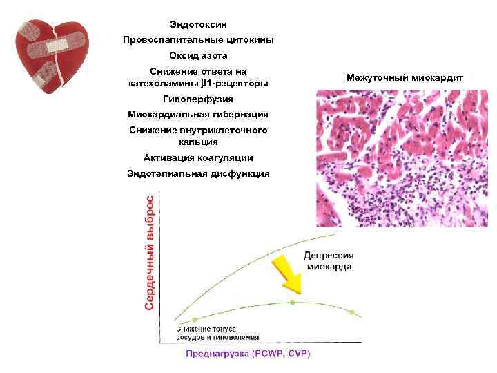 Эндотоксин Провоспалительные цитокины Оксид азота Снижение ответа на катехоламины 1 -рецепторы Гипоперфузия Миокардиальная гибернация