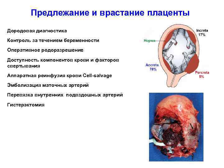 Предлежание и врастание плаценты Дородовая диагностика Контроль за течением беременности Оперативное родоразрешение Доступность компонентов