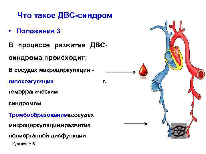 Что такое ДВС-синдром • Положение 3 В процессе развития ДВСсиндрома происходит: В сосудах макроциркуляции