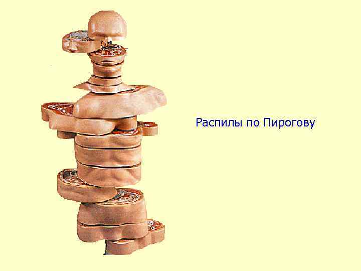 Распилы по Пирогову 