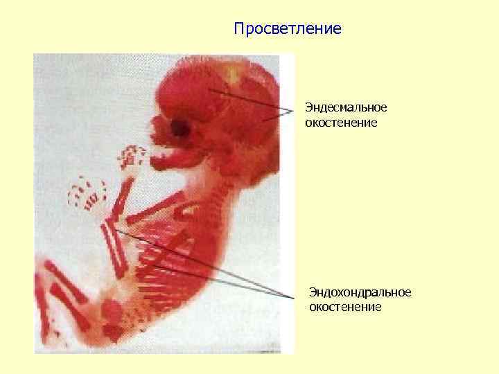 Просветление Эндесмальное окостенение Эндохондральное окостенение 