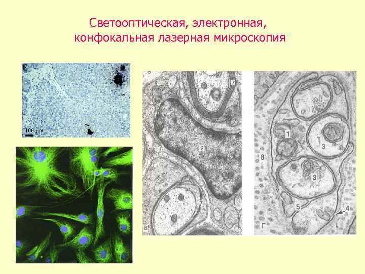Светооптическая, электронная, конфокальная лазерная микроскопия 