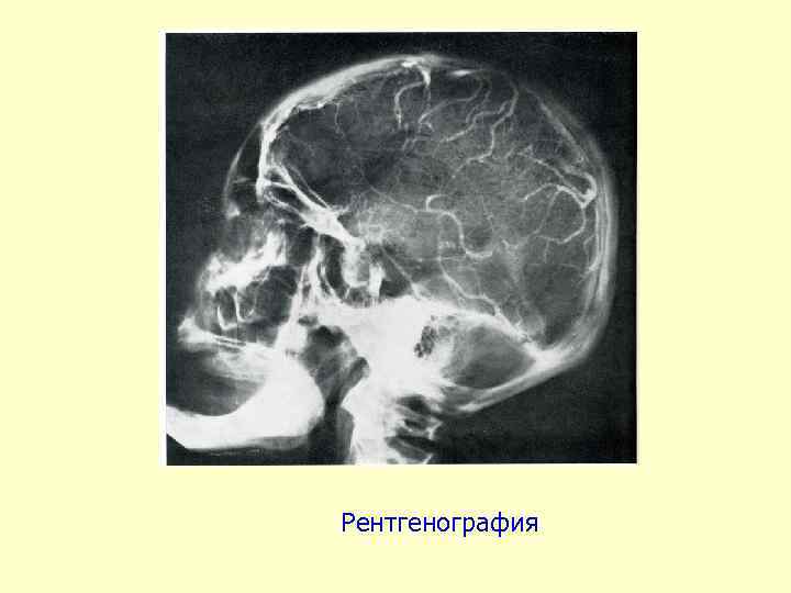 Рентгенография 