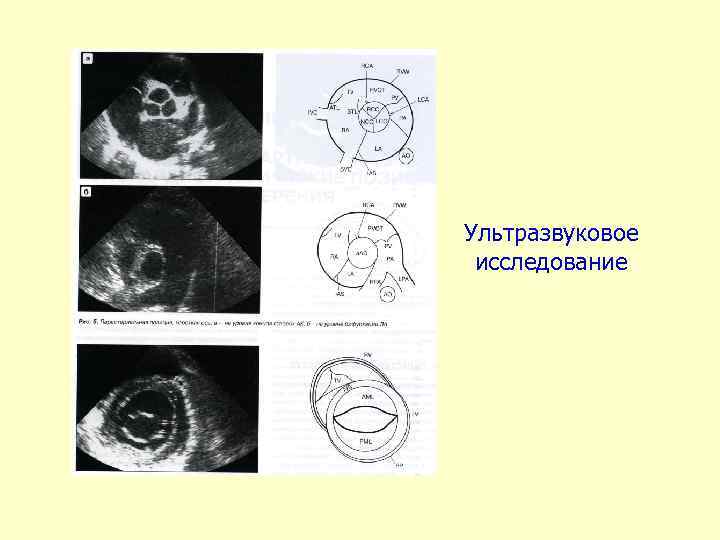 Ультразвуковое исследование 