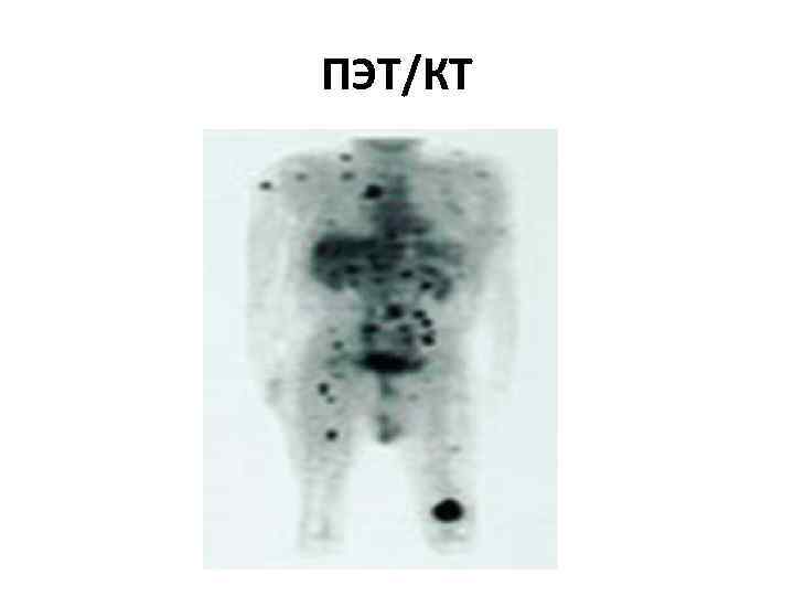 ПЭТ/КТ 