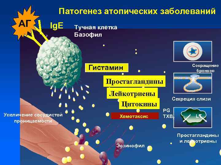 Патогенез атопических заболеваний АГ Ig. E Тучная клетка Базофил Сокращение бронхов Гистамин Простагландины Лейкотриены