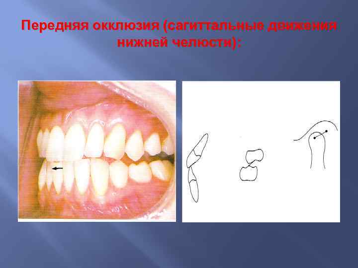 Восстановление и сохранение окклюзии в реставрационной стоматологии презентация