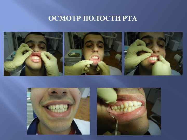 ОСМОТР ПОЛОСТИ РТА 