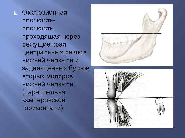 Окклюзионная схема кувата