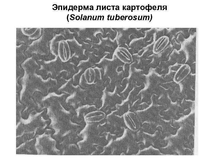 Эпидерма листа картофеля (Solanum tuberosum) 