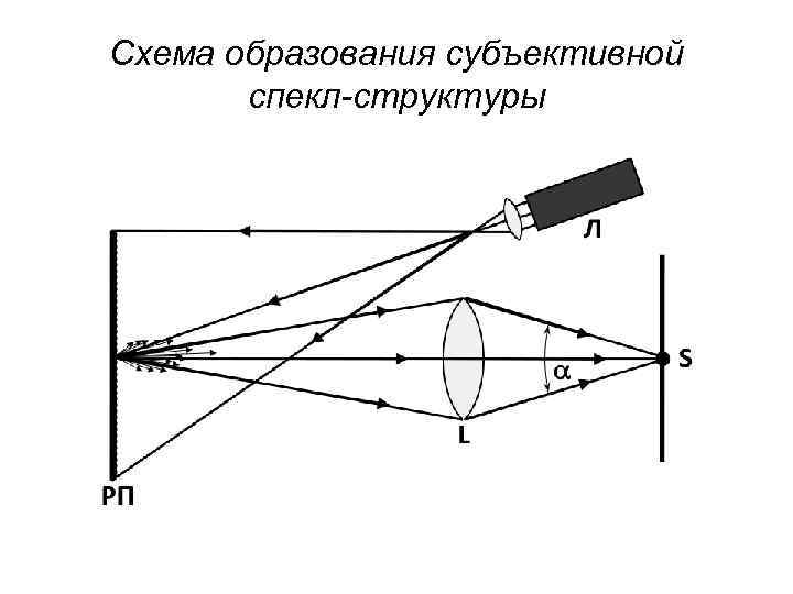 Схема образования субъективной спекл-структуры 