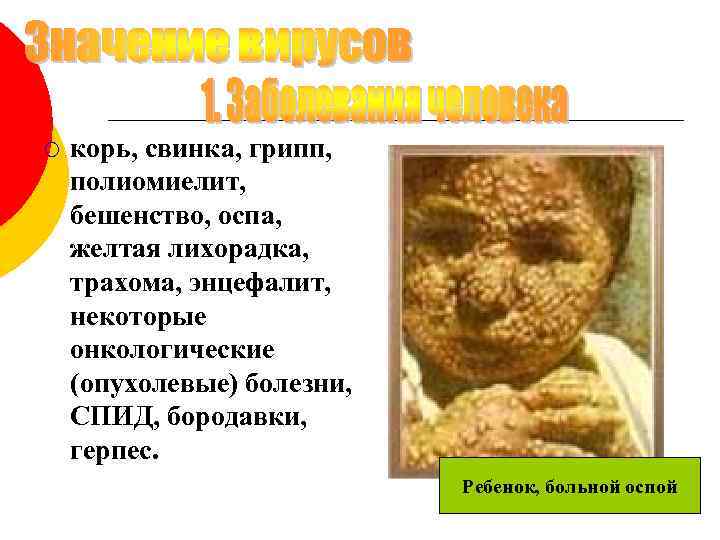 ¡ корь, свинка, грипп, полиомиелит, бешенство, оспа, желтая лихорадка, трахома, энцефалит, некоторые онкологические (опухолевые)