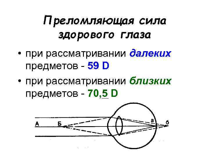 Преломляющая сила здорового глаза • при рассматривании далеких предметов - 59 D • при
