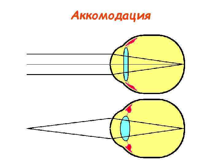 Аккомодация 