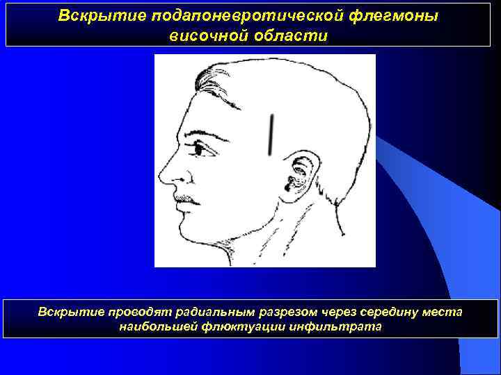 Оперативная хирургия лицевого отдела головы презентация