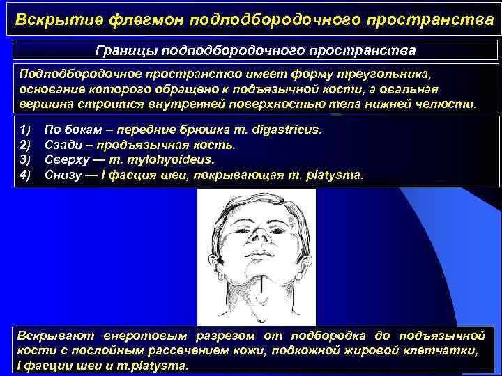 Вскрытие флегмон подподбородочного пространства Границы подподбородочного пространства Подподбородочное пространство имеет форму треугольника, основание которого